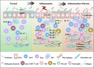 The role of Th17 cells in inflammatory bowel disease and the research progress